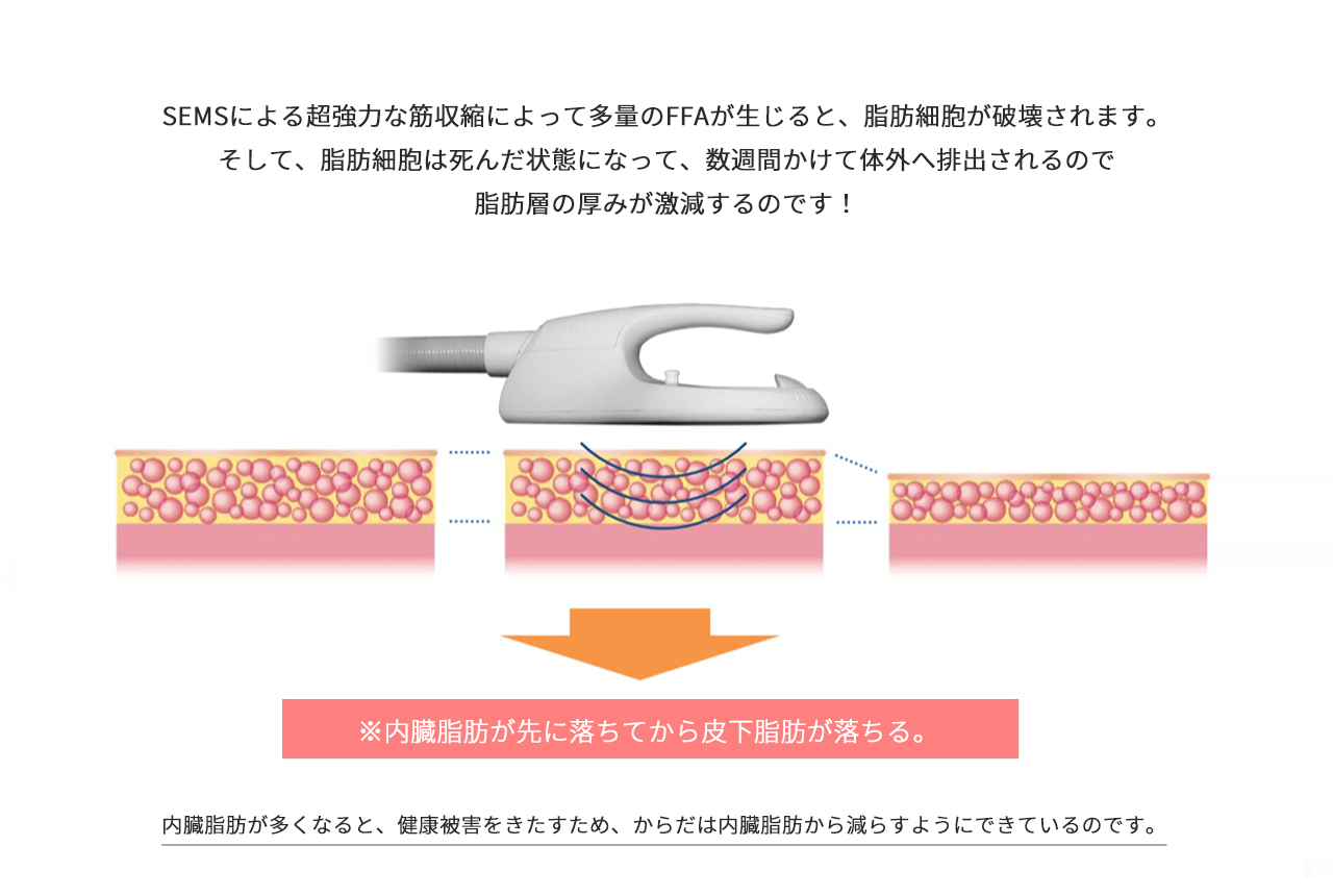 SEMSによる超強力な筋収縮によって多量のFFAが生じると、脂肪細胞が破壊されます。 そして、脂肪細胞は死んだ状態になって、数週間かけて体外へ排出されるので 脂肪層の厚みが激減するのです！